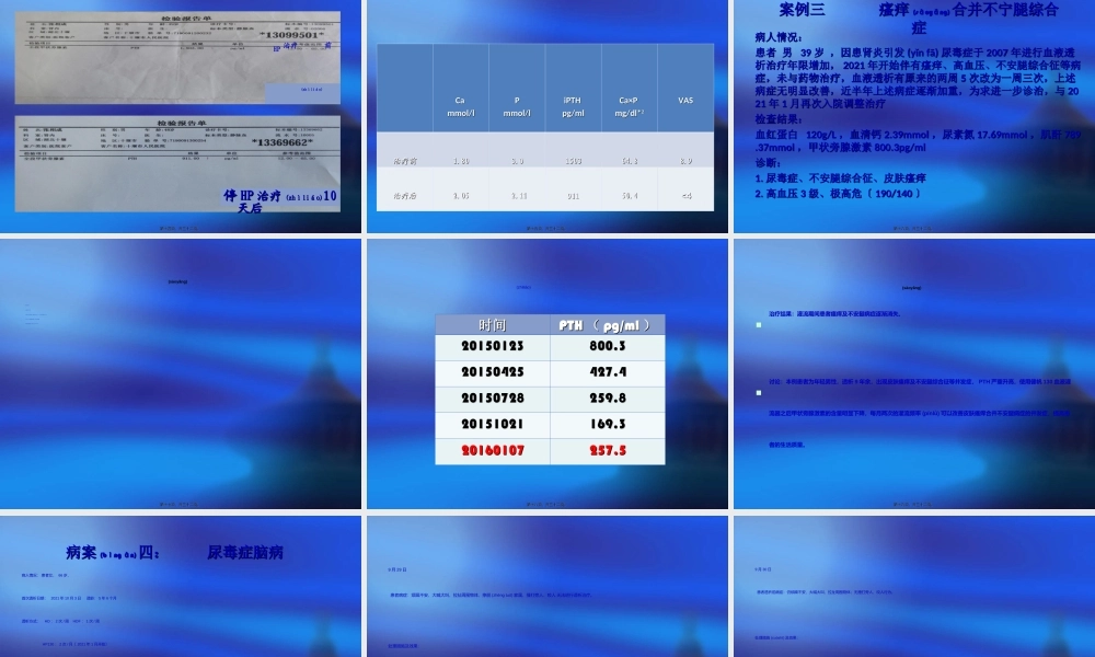 2022年医学专题—6-血液灌流典型病例分享---杨琴(1).ppt