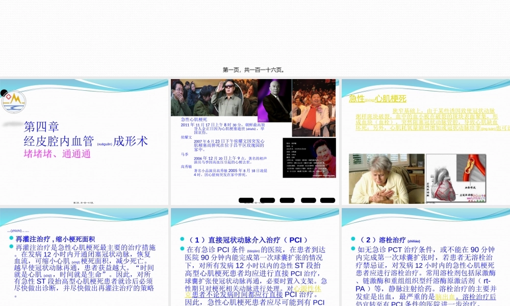 2022年医学专题—介入放射学第四章--经皮腔内血管成形术(1).ppt