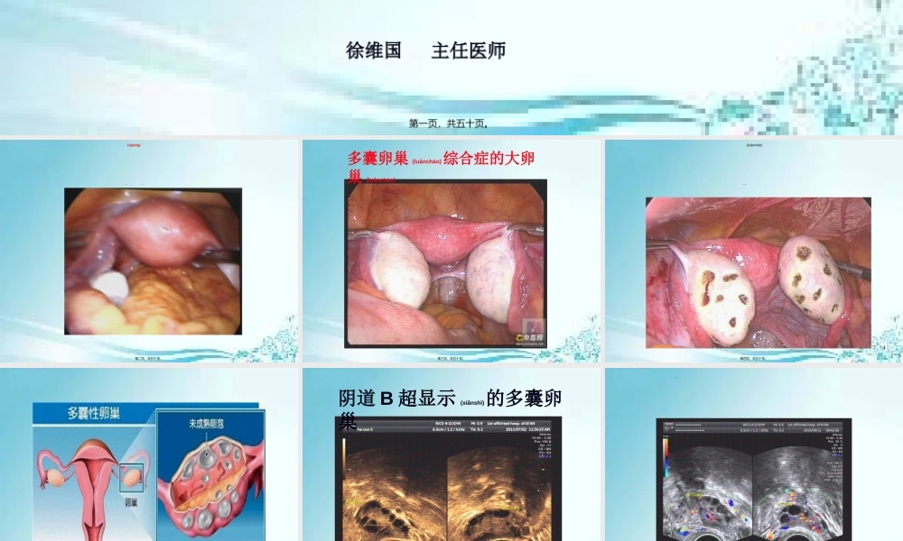 2022年医学专题—、多囊卵巢综合症(PCOS)(1).ppt