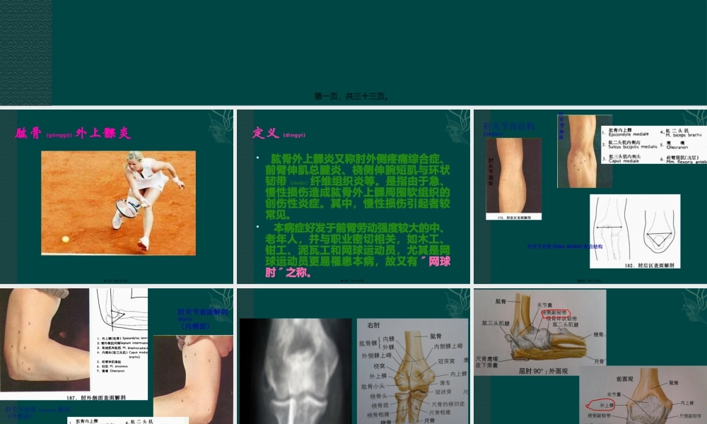 2022年医学专题—何龙肱骨外上髁炎(1).pptx