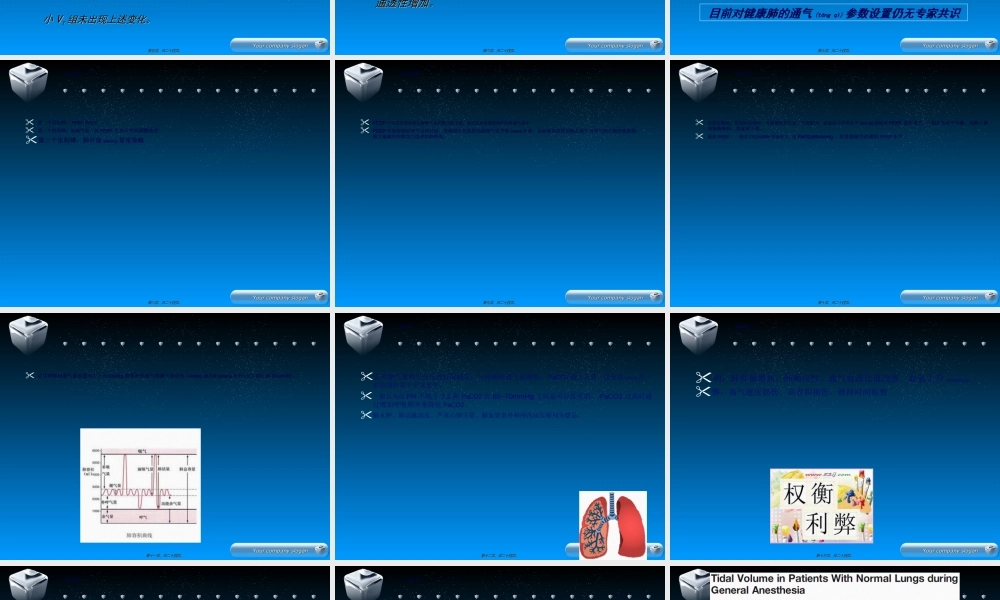 2022年医学专题—保护性肺通气策略jtt(1).ppt