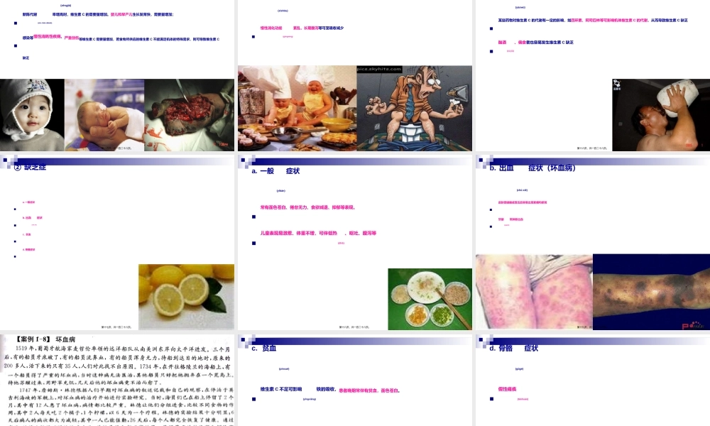 2022年医学专题—《烹饪营养学》第八讲-水溶性维生素(1).ppt