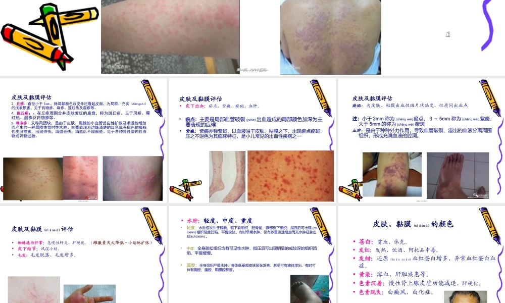 2022年医学专题—健康评估6--身体状况评估-2-头颈胸-64P概要(1).ppt