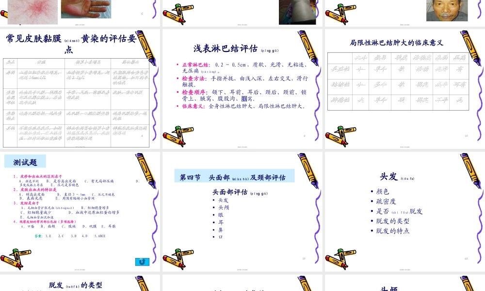 2022年医学专题—健康评估6--身体状况评估-2-头颈胸-64P概要(1).ppt