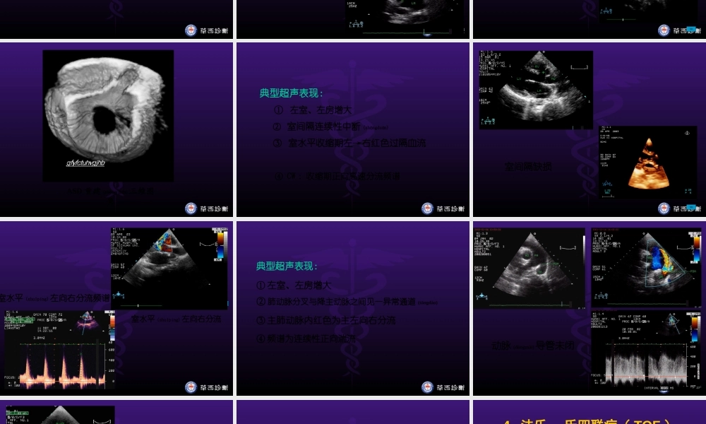 2022年医学专题—华西医科大精品课程-超声心动图3-异常(1).ppt