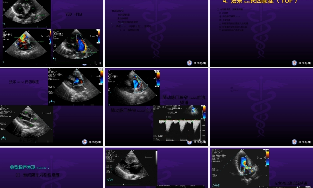 2022年医学专题—华西医科大精品课程-超声心动图3-异常(1).ppt