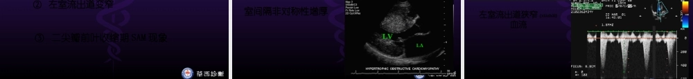 2022年医学专题—华西医科大精品课程-超声心动图3-异常(1).ppt