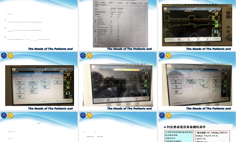 2022年医学专题—呼吸机的使用及撤机(1).ppt
