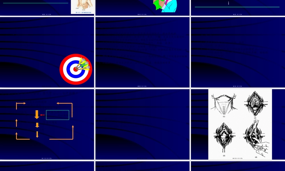 2022年医学专题—喉阻塞(1).ppt