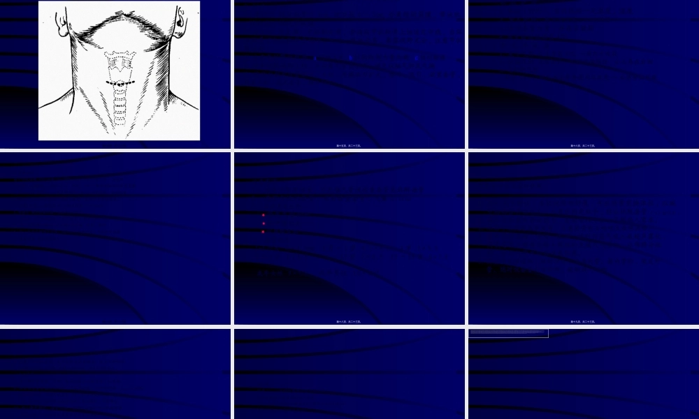 2022年医学专题—喉阻塞(1).ppt
