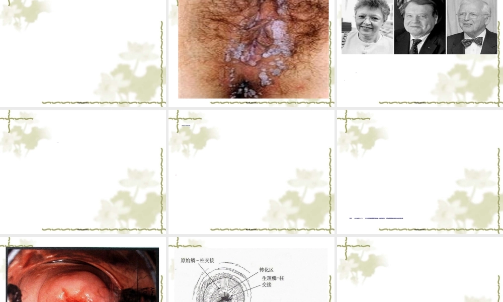 2022年医学专题—宫颈癌-PPT模板(1).ppt
