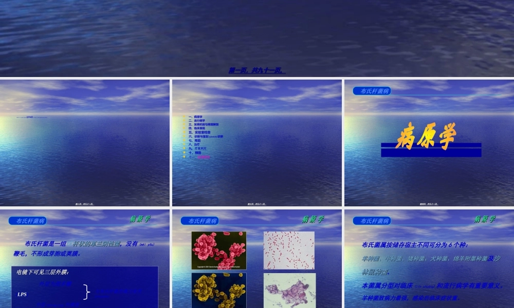 2022年医学专题—布氏杆菌病----郭龙江(1).ppt