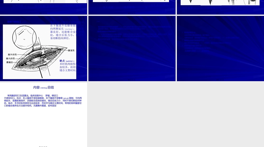 2022年医学专题—常用腹部切口及显露法(1).ppt