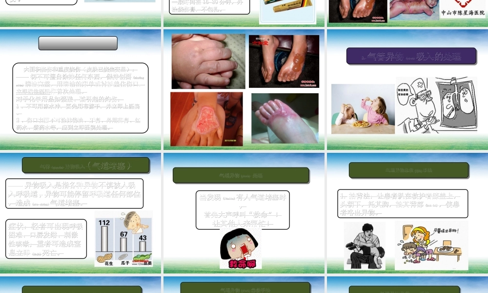 2022年医学专题—常见意外伤害的处理.(1).ppt