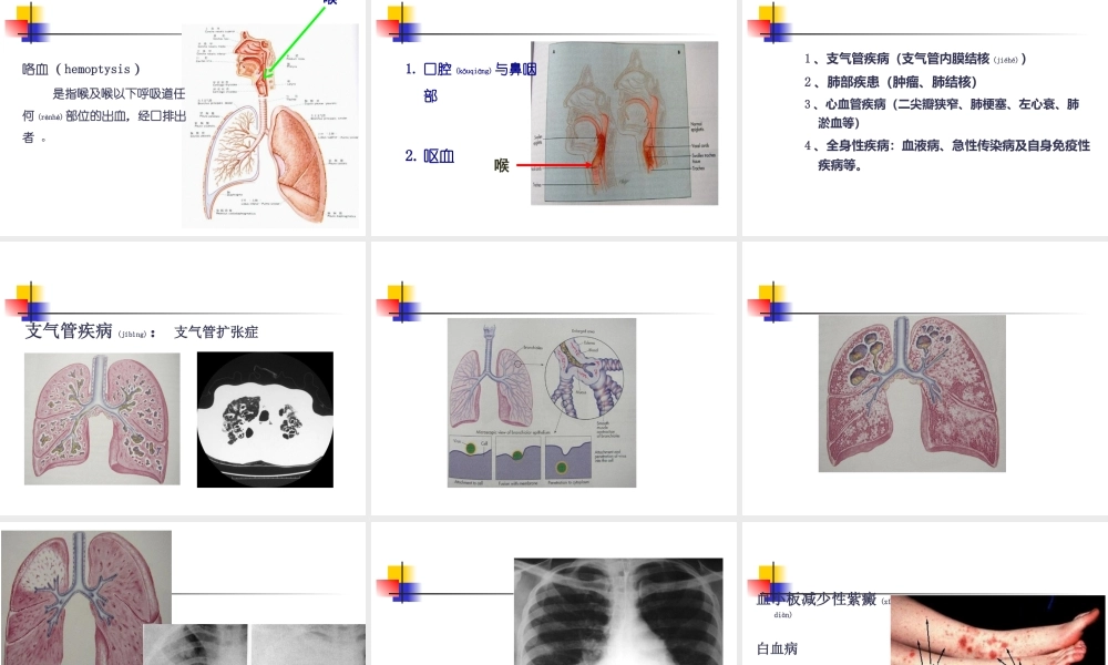 2022年医学专题—常见症状：呼吸系统(1).ppt