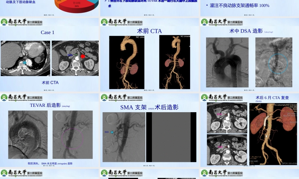 2022年医学专题—急性Stanford-B型AD并灌注不良的处理(1).pptx