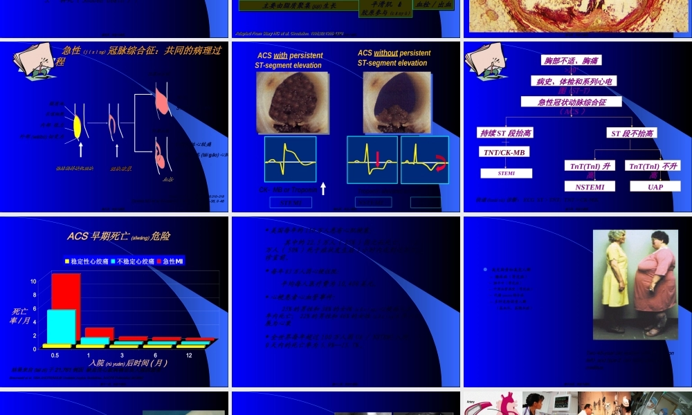 2022年医学专题—急性冠脉综合征诊治进展(1).ppt