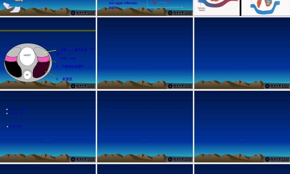 2022年医学专题—急性呼吸窘迫综合征的通气策略(1).ppt