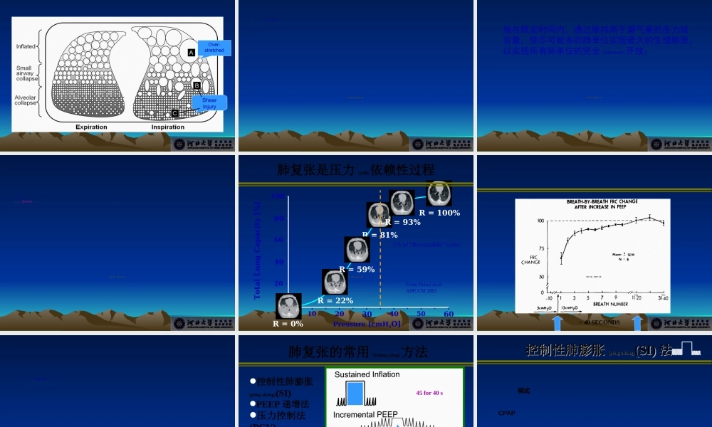 2022年医学专题—急性呼吸窘迫综合征的通气策略(1).ppt