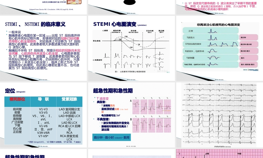 2022年医学专题—急性心肌梗死心电图及指南部分分析(1).pptx