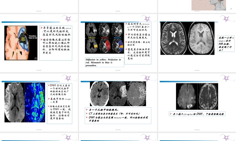 2022年医学专题—急性脑梗塞溶栓成功关键因素概论(1).ppt