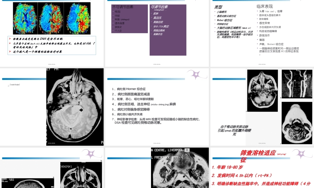 2022年医学专题—急性脑梗塞溶栓成功关键因素概论(1).ppt