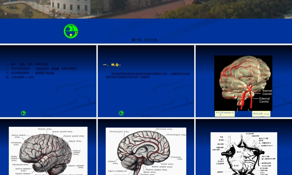 2022年医学专题—急性脑血管病浅论(1).ppt