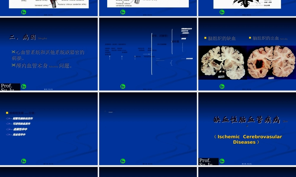2022年医学专题—急性脑血管病浅论(1).ppt