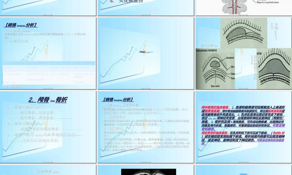 2022年医学专题—急性颅脑损伤概要(1).ppt