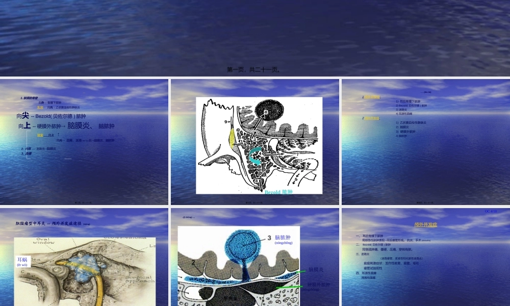 2022年医学专题—慢性化脓性中耳炎并发症(1).ppt