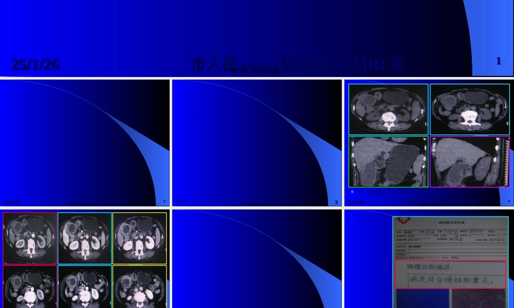 2022年医学专题—慢性化脓性胆囊炎(1).ppt