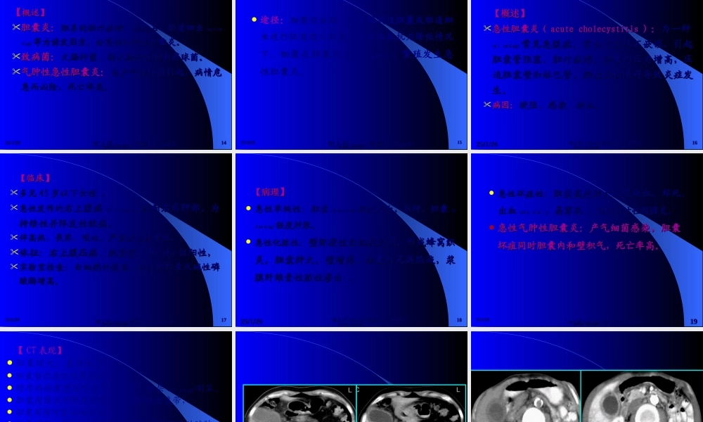2022年医学专题—慢性化脓性胆囊炎(1).ppt