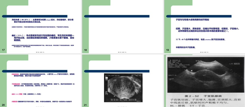 2022年医学专题—教学查房子宫腺肌病-(2)(1).ppt
