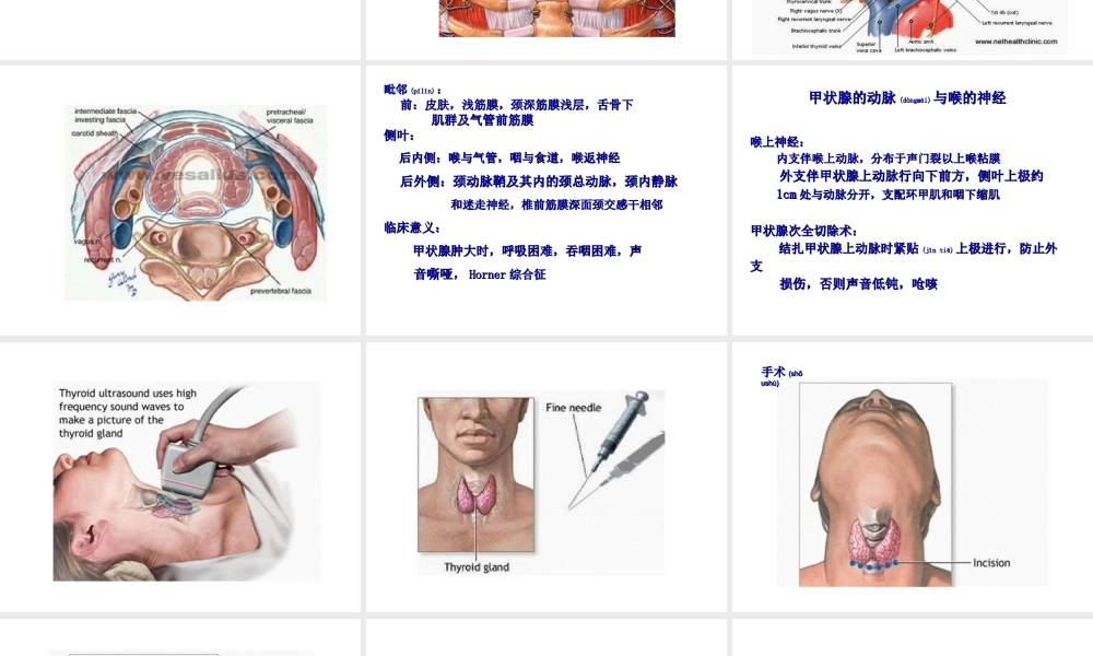 2022年医学专题—甲状腺切除术.ppt(1).ppt
