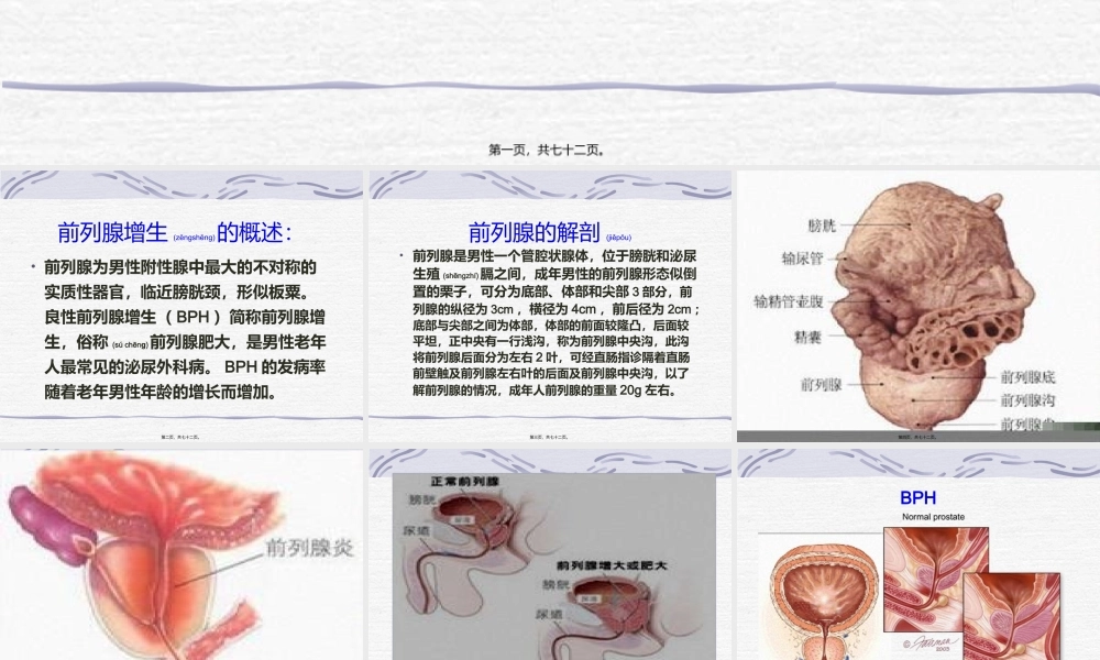 2022年医学专题—男科病-前列腺增生(1).ppt