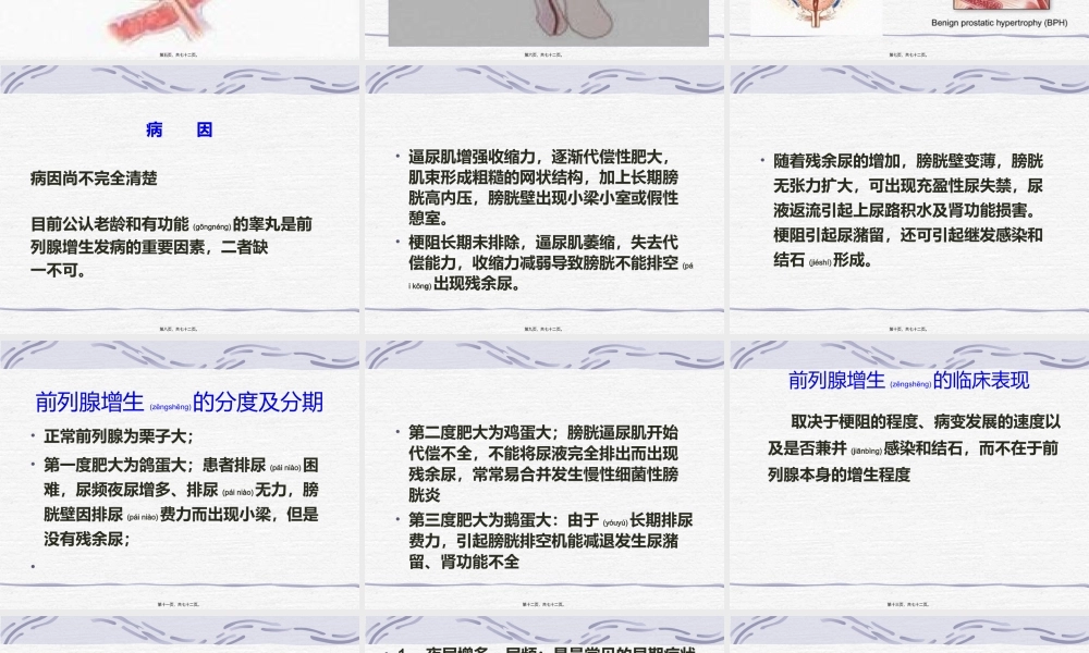 2022年医学专题—男科病-前列腺增生(1).ppt