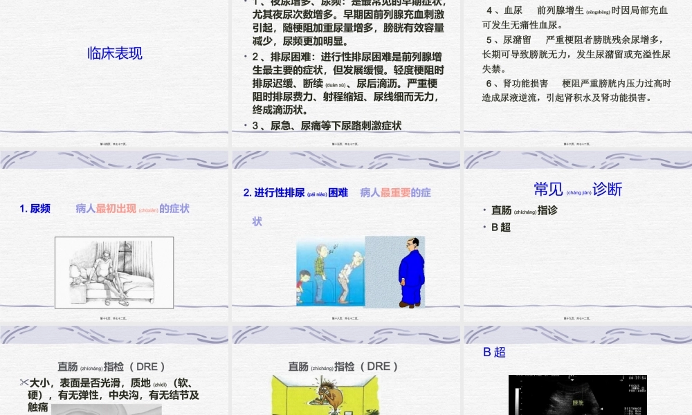 2022年医学专题—男科病-前列腺增生(1).ppt