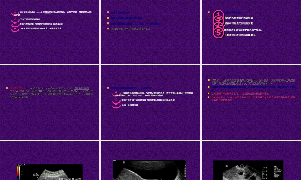 2022年医学专题—疤痕妊娠(1).ppt