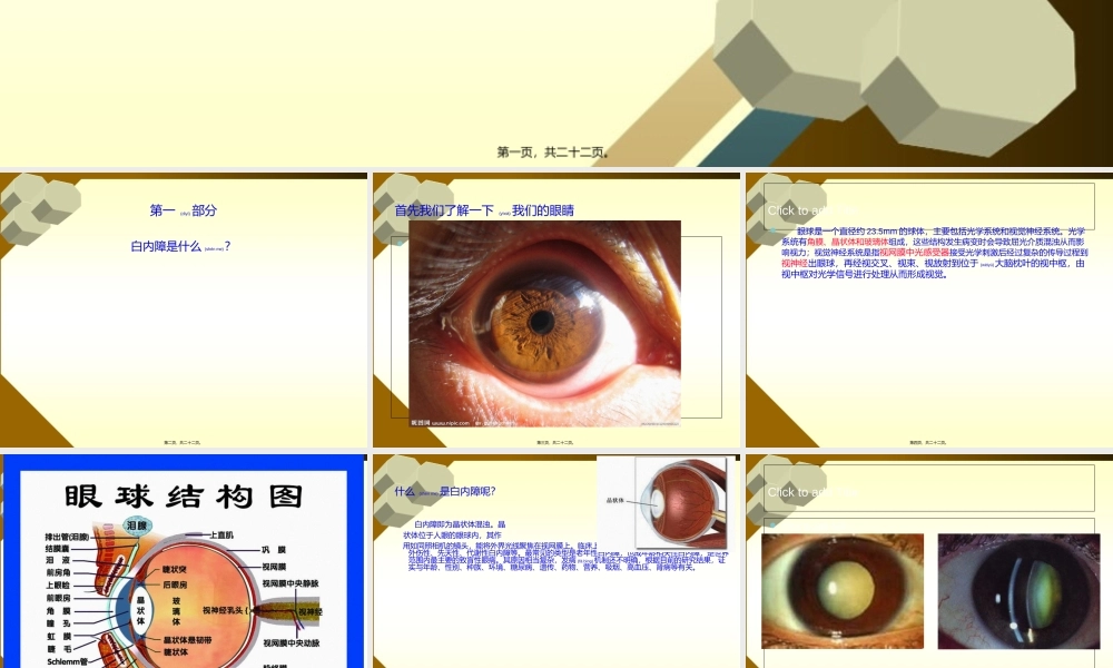 2022年医学专题—白内障术前谈话(1).ppt