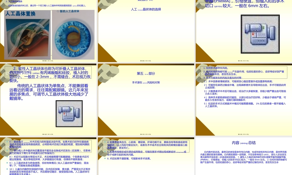 2022年医学专题—白内障术前谈话(1).ppt