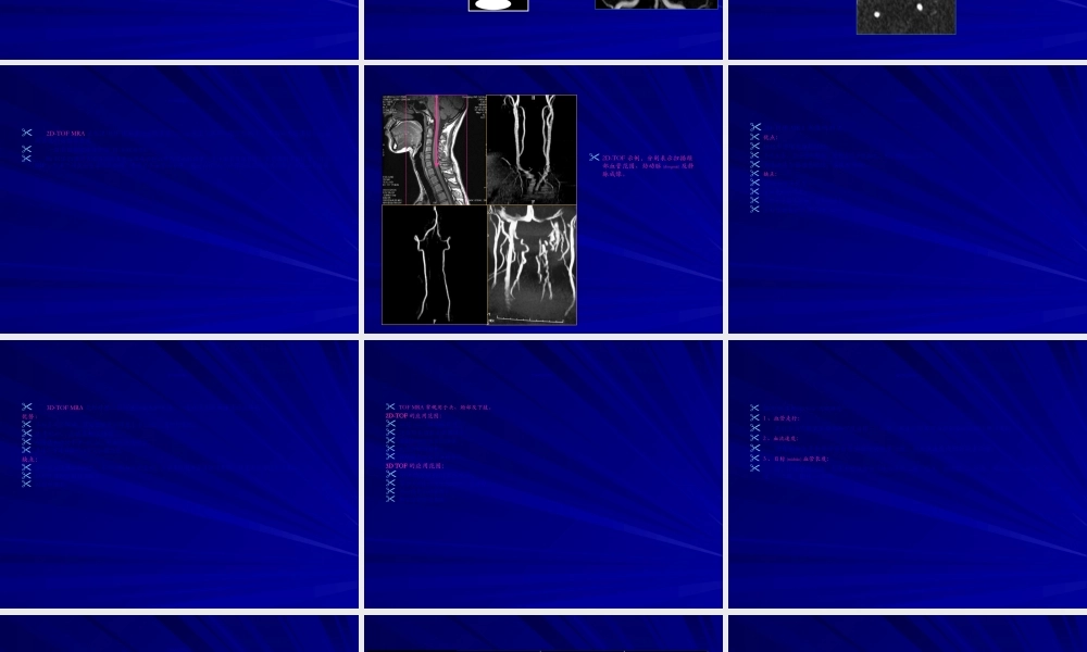 2022年医学专题—磁共振血管成像(MRA)(1).ppt