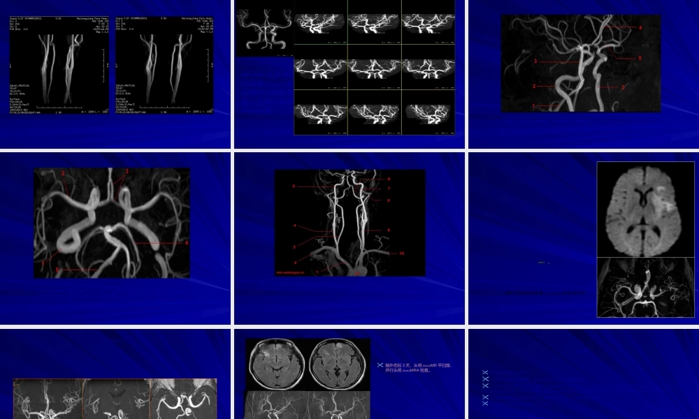 2022年医学专题—磁共振血管成像(MRA)(1).ppt