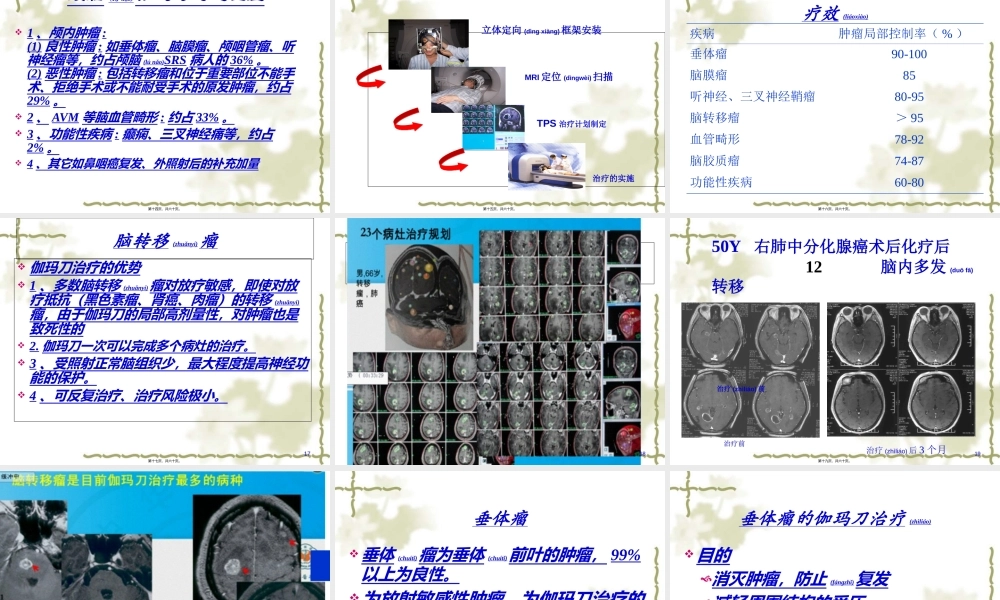 2022年医学专题—立体定向放射外科(1).ppt