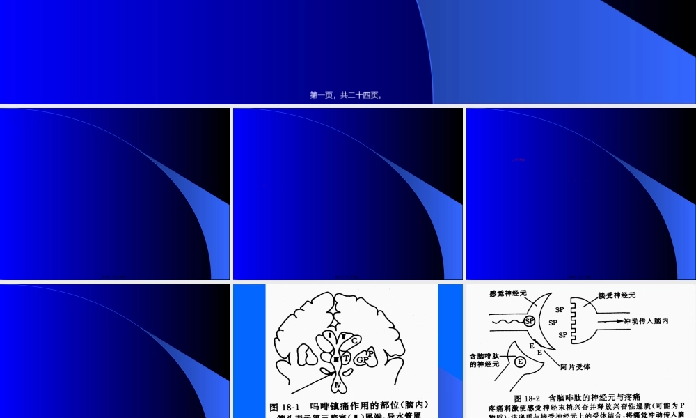 2022年医学专题—第14讲-镇痛药(1).ppt
