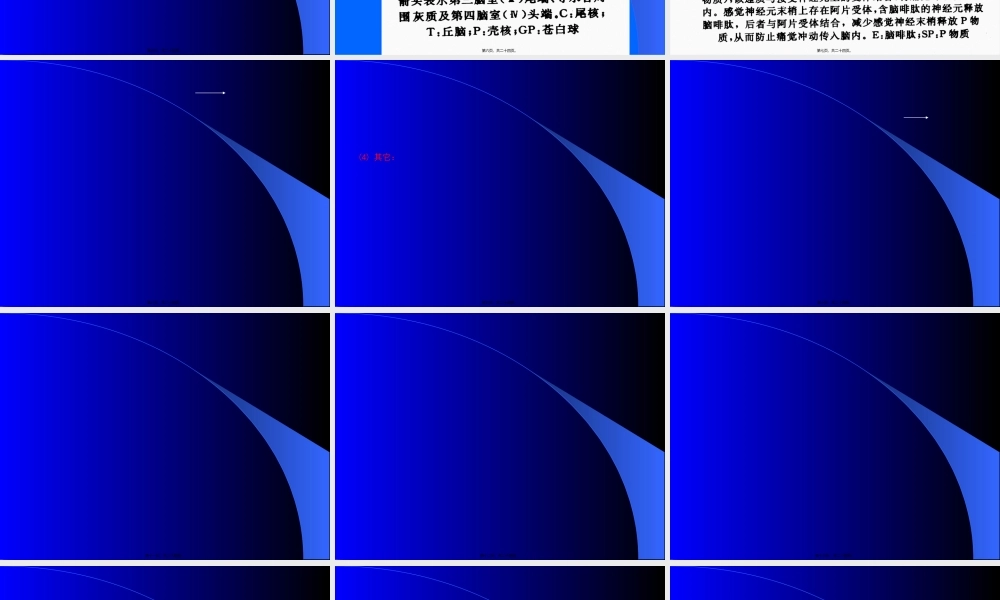 2022年医学专题—第14讲-镇痛药(1).ppt