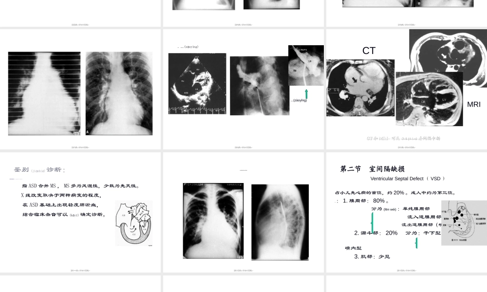 2022年医学专题—第十章-先天性心血管病(1).ppt