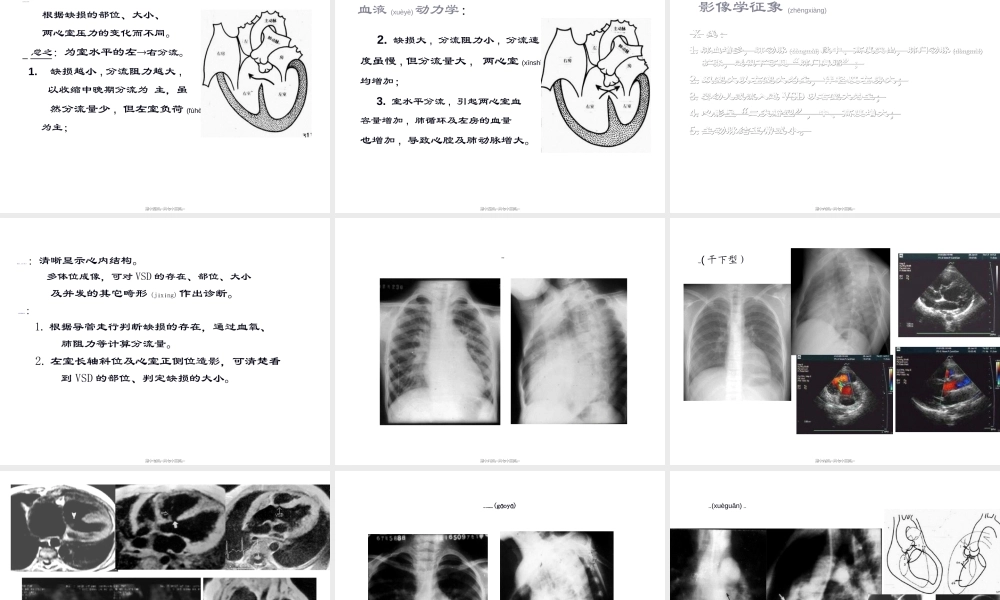 2022年医学专题—第十章-先天性心血管病(1).ppt