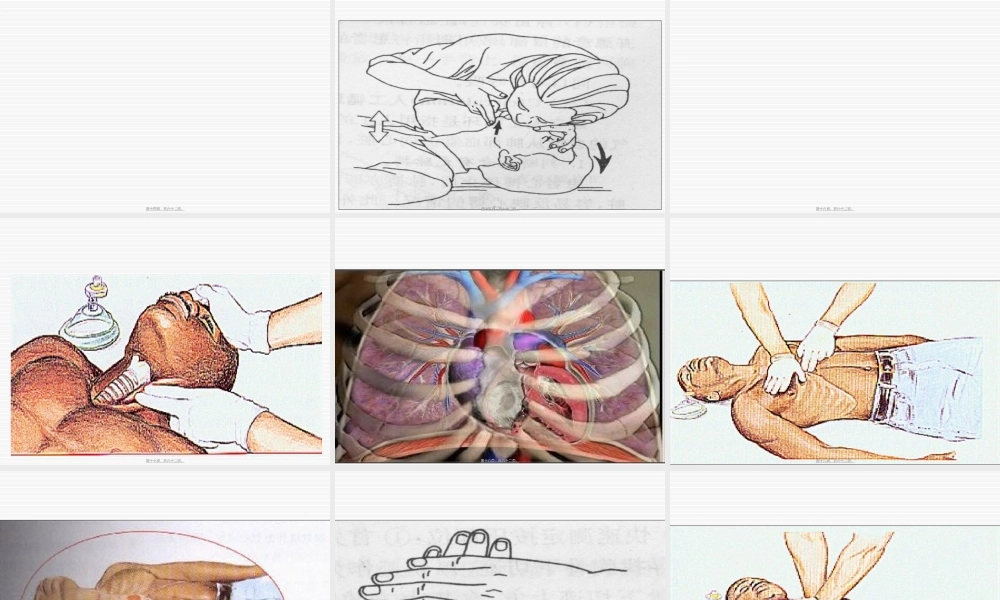 2022年医学专题—紧急救护-健康知识讲座(1).ppt