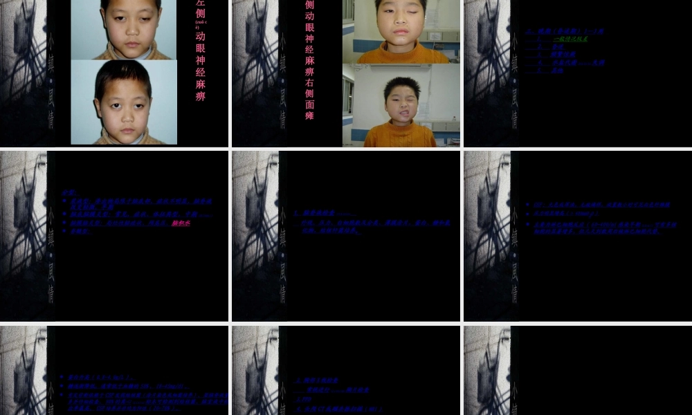 2022年医学专题—结核性脑膜炎幻灯片(1).ppt