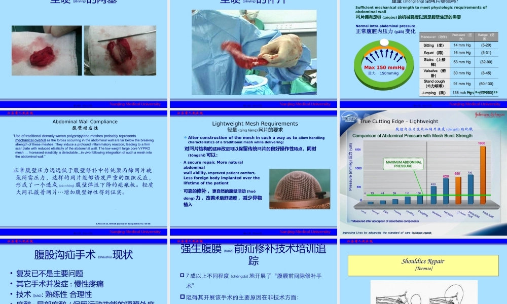 2022年医学专题—经腹股沟腹膜前腹股沟疝修补术(1).pptx